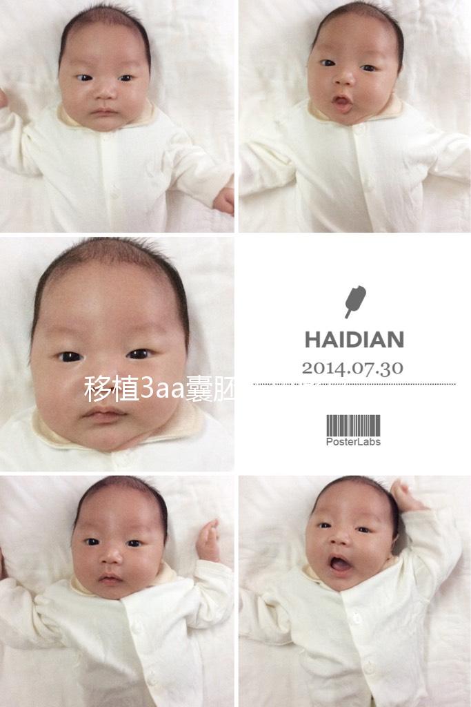 移植3aa囊胚成功率高嗎？詳解質量等級助孕更放心