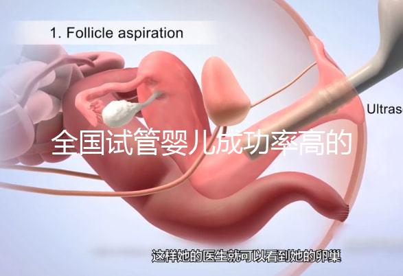 全國(guó)試管嬰兒成功率高的醫(yī)院有哪些？（全國(guó)試管嬰兒成功率高的醫(yī)院目錄一覽）