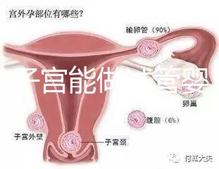 雙角子宮能做試管嬰兒嗎？可以，但這2大條件缺一不可