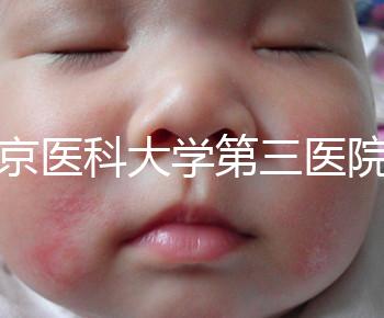 北京醫(yī)科大學第三醫(yī)院nt檢查費用盤點需要多長時間，是否預約