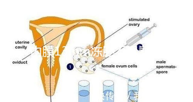 內膜13mm凍胚不易著床要注意，移植與否看醫(yī)生怎么說