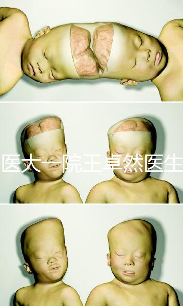 哈醫(yī)大一院王卓然醫(yī)生試管攻略,坐診時間、成功率早知道