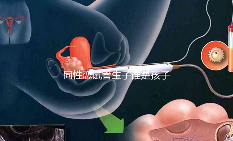 同性戀試管生子誰(shuí)是孩子爸惹爭(zhēng)議！血緣關(guān)系竟成迷