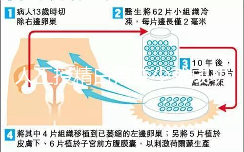 人工授精白帶變少就成功了嗎?是好是壞,14天后"它"說了算