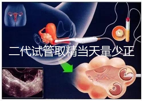 二代試管取精當(dāng)天量少正不正常60s弄清，不造怎么辦速覽