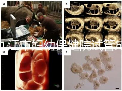 九江市婦幼保健院試管成功率高、費(fèi)用低？生殖醫(yī)生揭開真相