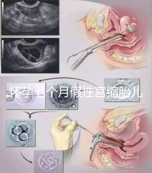 懷孕七個(gè)月假性宮縮胎兒可能缺氧,處理不好對(duì)胎兒影響大