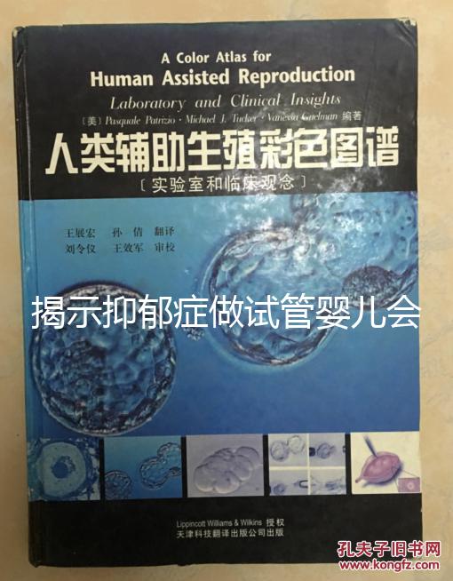 揭示抑郁癥做試管嬰兒會遺傳給女兒，想避免看這個