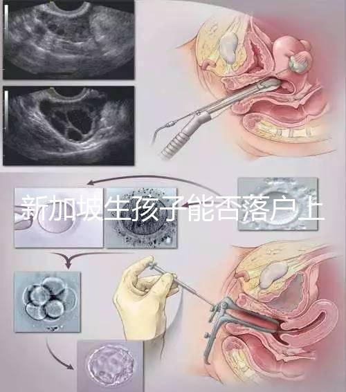 新加坡生孩子能否落戶上海分，@家長:高學歷可以申請