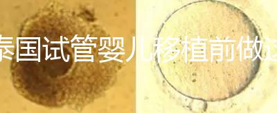 泰國試管嬰兒移植前做這3件事能提高成功率，不然會后悔！