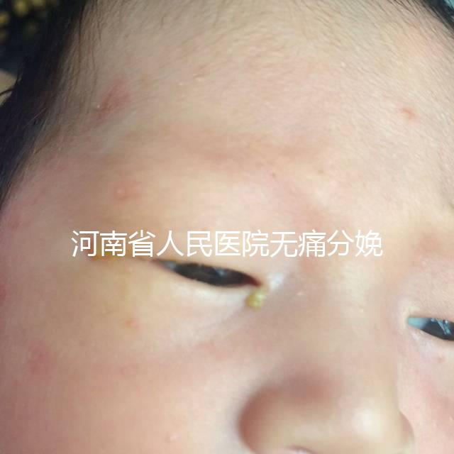 河南省人民醫(yī)院無(wú)痛分娩多少錢(qián)戳，收費(fèi)標(biāo)準(zhǔn)60s看懂不踩坑