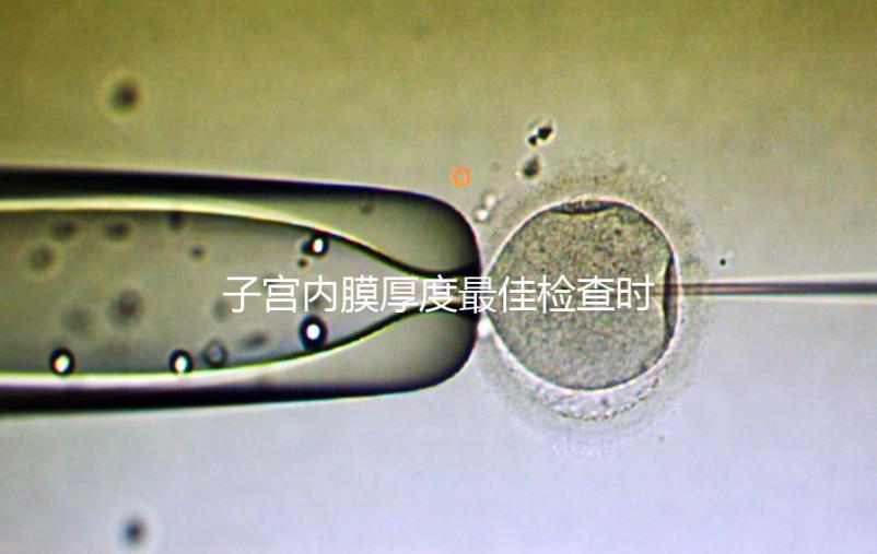 子宮內膜厚度最佳檢查時期，你有必要提前知道！