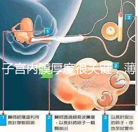 子宮內膜厚度很關鍵，薄了厚了試管嬰兒都難成功