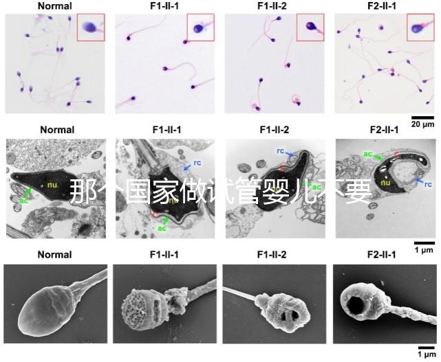 那個國家做試管嬰兒不要結婚證