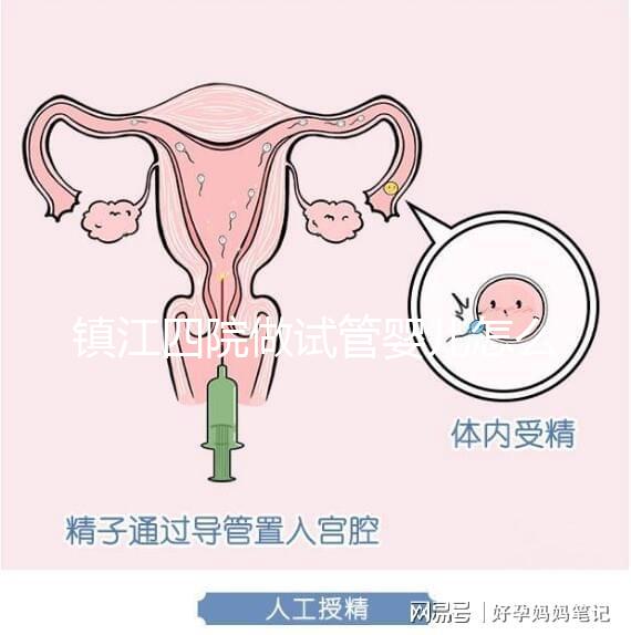 鎮江四院做試管嬰兒怎么樣?具體成功率費用介紹