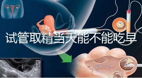 試管取精當(dāng)天能不能吃早餐喝水的答案來(lái)咯咯，好不好一看就知道了？