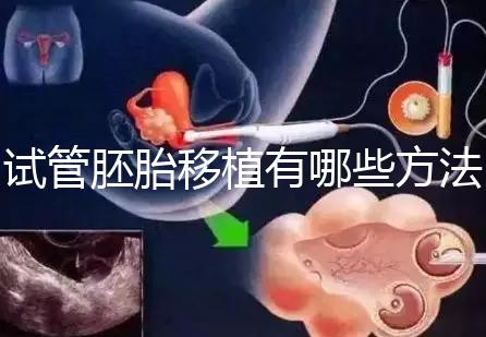 試管胚胎移植有哪些方法？
