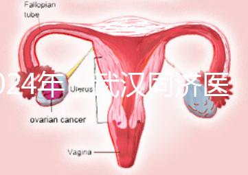 2024年，武漢同濟(jì)醫(yī)院不孕癥醫(yī)生排名公布，選擇專(zhuān)家迅速登記